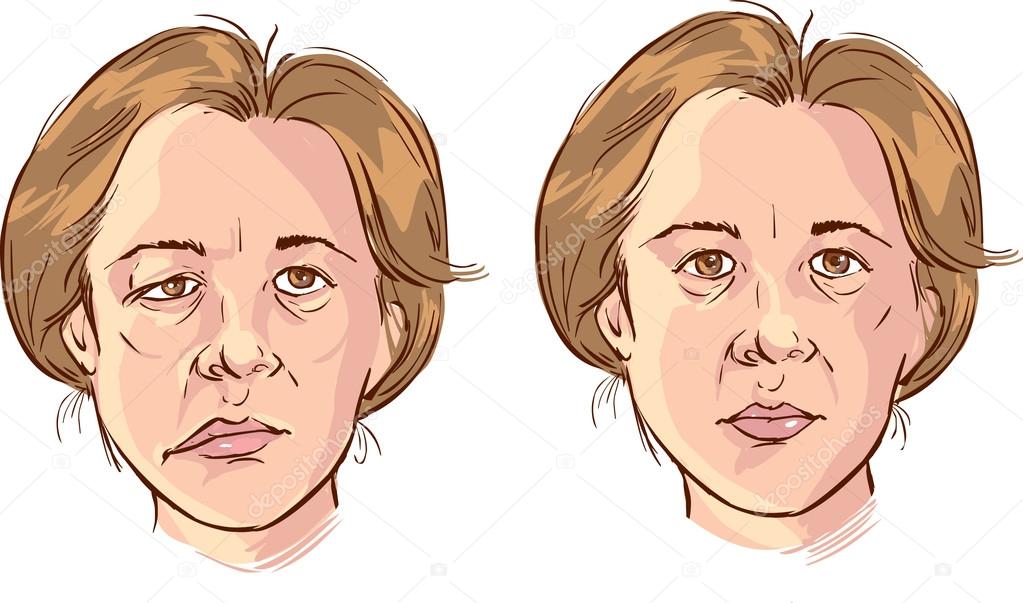 facial lopsided illustration