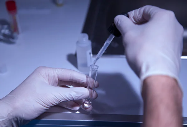 Proceso de extracción de suero sanguíneo — Foto de Stock