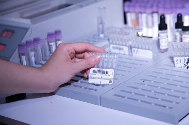 kan serumu ayıklama işlemi