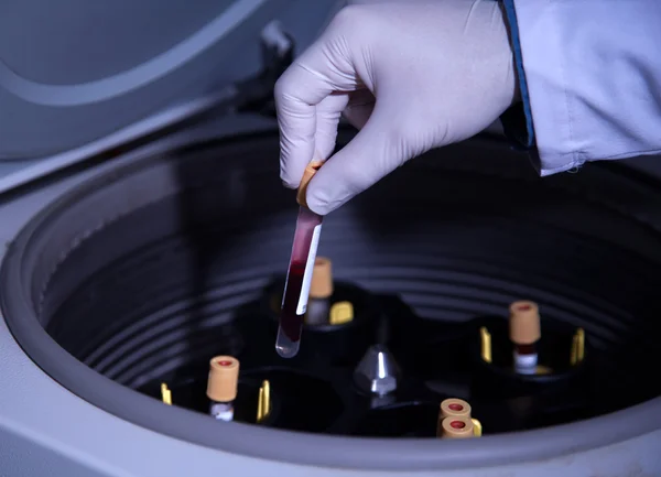 Processo di estrazione del siero del sangue — Foto Stock