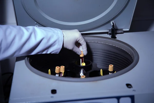 Processo di estrazione del siero del sangue — Foto Stock