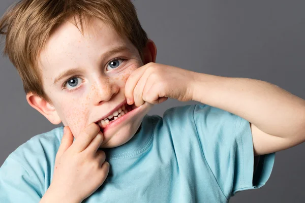 Menino de 6 anos mostrando seu dente desaparecido para cuidados de saúde — Fotografia de Stock