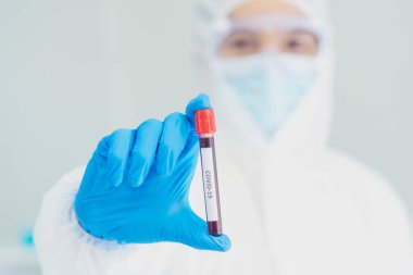 Bilim adamı covid-19 virüs kimya araştırması biyoteknoloji antikor örneği laboratuvarı virüse karşı aşı üretiyor. Bilim adamı mikroskoba bakıyor, bilim test tüpü kimya laboratuvarını analiz ediyor.