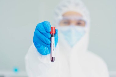 Bilim adamı covid-19 virüs kimya araştırması biyoteknoloji antikor örneği laboratuvarı virüse karşı aşı üretiyor. Bilim adamı mikroskoba bakıyor, bilim test tüpü kimya laboratuvarını analiz ediyor.