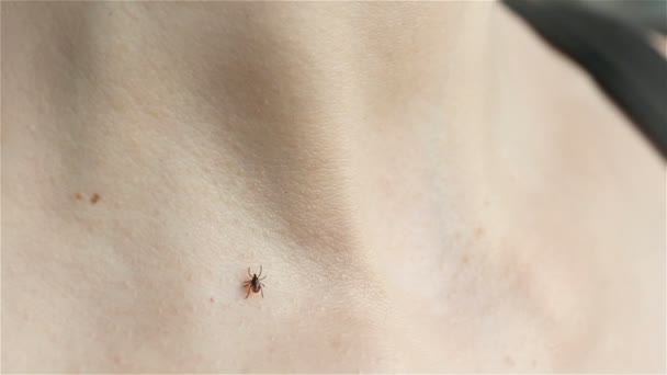 Tick crawling on human Skin — Stock Video