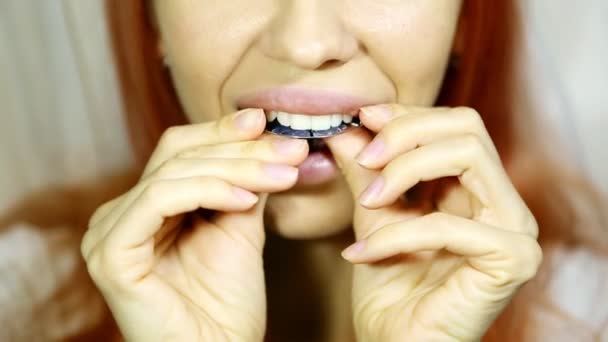 Mãos segurando retentor para dentes e bandeja de dentes Menina sorridente bonita segurando retentor para dentes (aparelhos dentários) e bandeja de dente individual — Vídeo de Stock