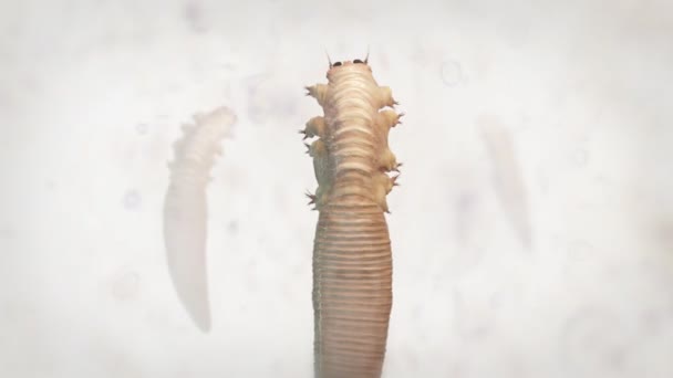 Demodex Folliculorum. Demodicosis. — Stok video