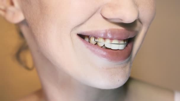 Bella ragazza sorridente con fermo per i denti, primo piano . — Video Stock