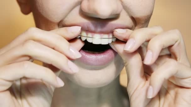 Krásná usměvavá dívka s úchyt pro zuby, detail. — Stock video