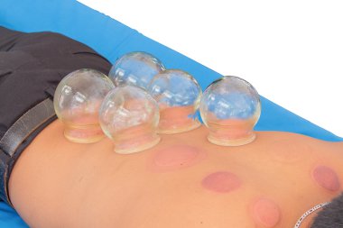 Yangın çukurluğu kaldırma