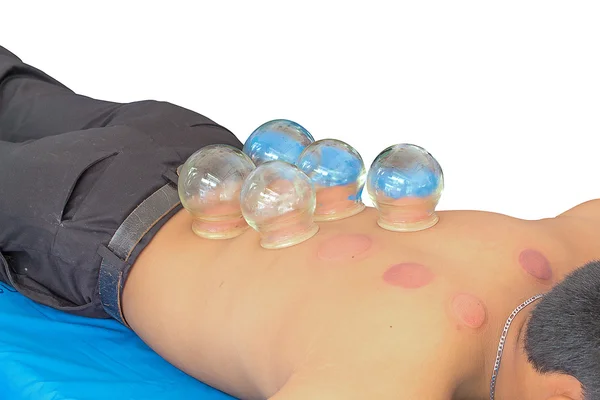 Yangın çukurluğu kaldırma