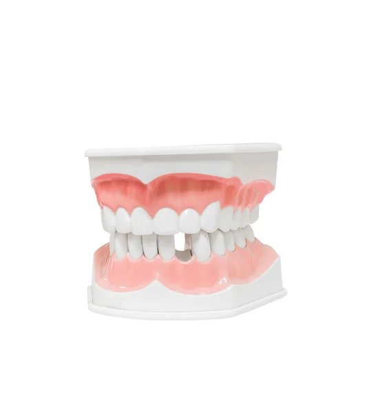 Стоматологічна модель зубів зламаного зуба , Ізольовані на білому фоні відсікаючий контур — стокове фото