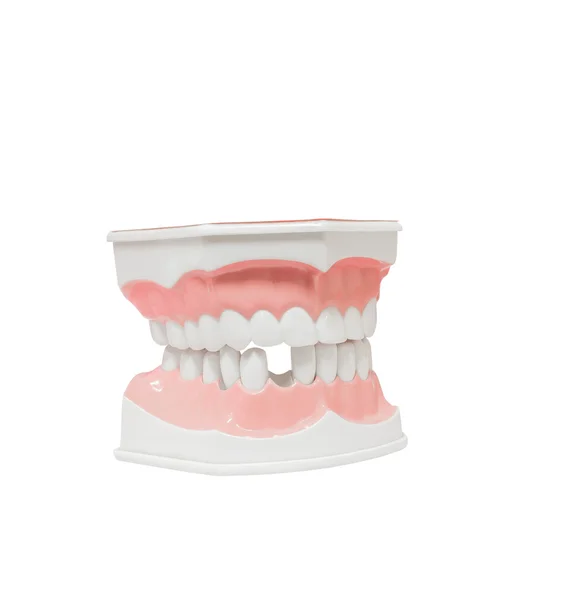 Dental Model of Teeth  broken tooth , Isolated on white background clipping path — Stock Photo, Image