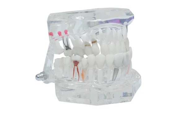Modelo dental de dientes, aislado en el camino de recorte de fondo blanco — Foto de Stock