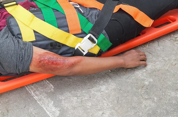 Pasien sakit lengan atas, tunggu dokter membantu pasien dalam situasi darurat penyelamatan, tandu — Stok Foto
