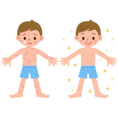 Çocuk ve dermatit olmadan