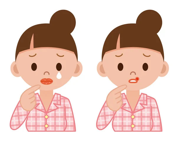 Hastalık dudak — Stok Vektör
