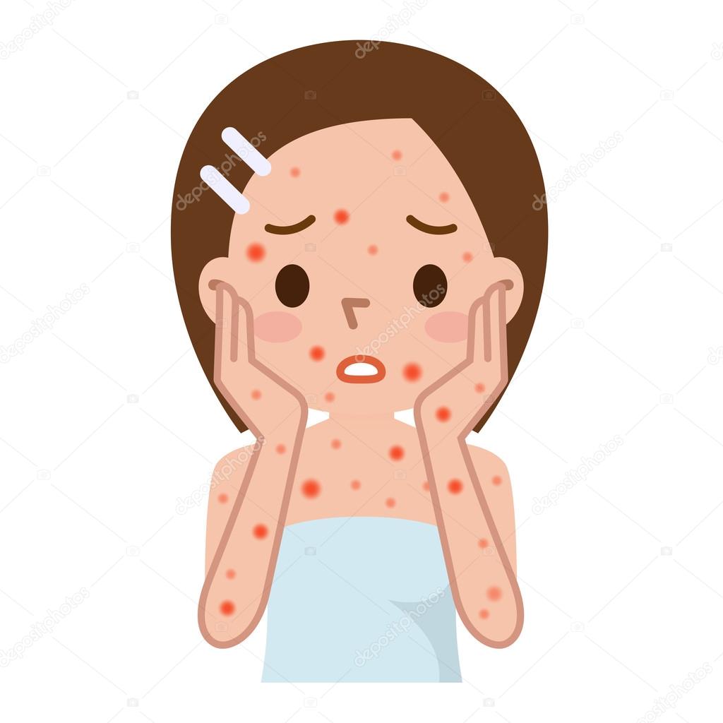 Woman with red spots on face and body 