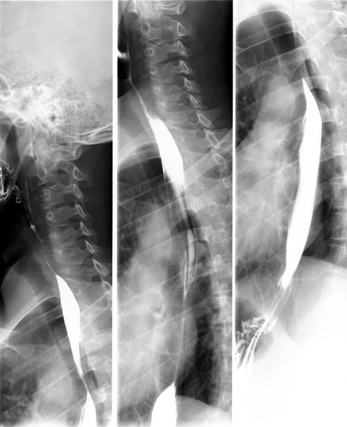 Radiography in three parts, x-ray — Stock Photo, Image