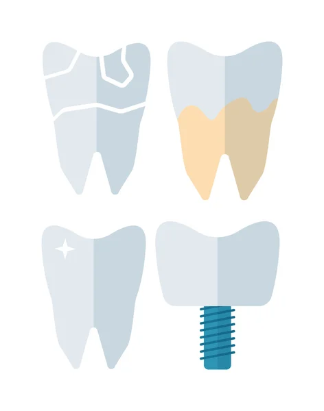 Diş implantı vektör çizimi — Stok Vektör