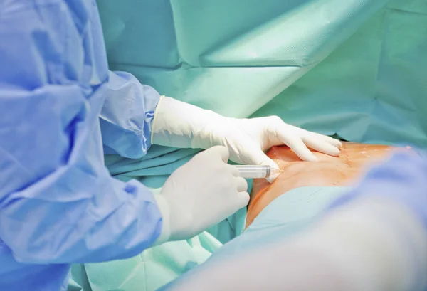 Cirugía de aumento de senos en el quirófano implante de herramientas de cirujano — Foto de Stock