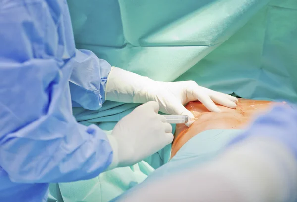 Breast augmentation surgery in the operating room surgeon tools implant — Stock Photo, Image