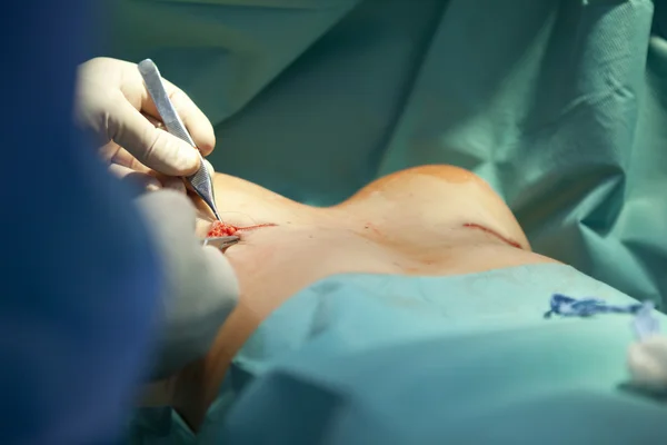 breast augmentation surgery in the operating room surgeon tools implant