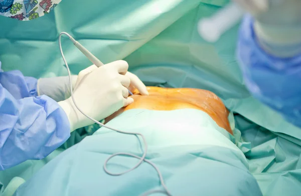 Εμφυτεύματος χειρουργική επέμβαση αύξησης στηθών στο χειρουργείο χειρουργός εργαλεία Royalty Free Φωτογραφίες Αρχείου