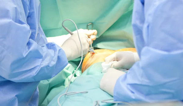 Εμφυτεύματος χειρουργική επέμβαση αύξησης στηθών στο χειρουργείο χειρουργός εργαλεία Φωτογραφία Αρχείου