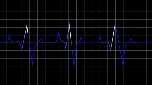 心電図ストック動画 ロイヤリティフリー心電図動画 Depositphotos