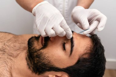 Erkek müşteriye akupunktur yapan tanınmamış işçilerin resmi.