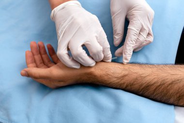 Erkek müşteriye akupunktur yapan tanınmamış işçilerin resmi.