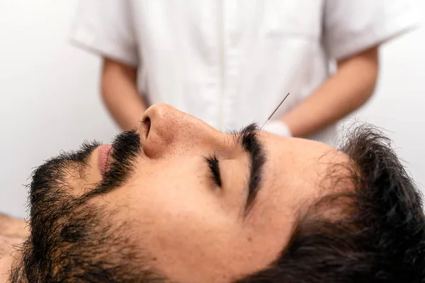 Foto Stock Trabajador Reconocido Haciendo Procedimiento Acupuntura Cliente Masculino —  Fotos de Stock