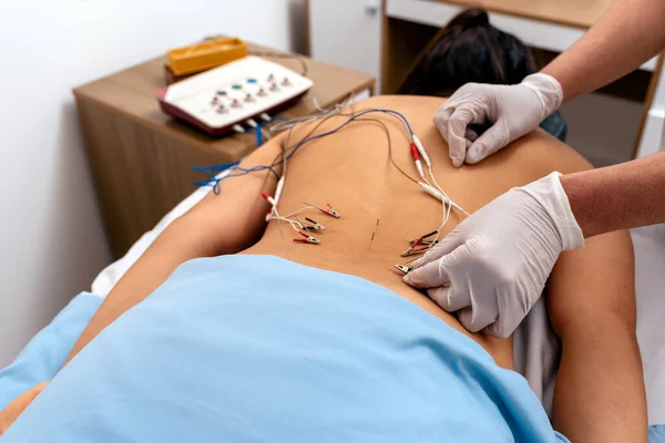 Stock Photo Anonymous Person Having Acupuncture Treatment Back Pain — Stock Photo, Image