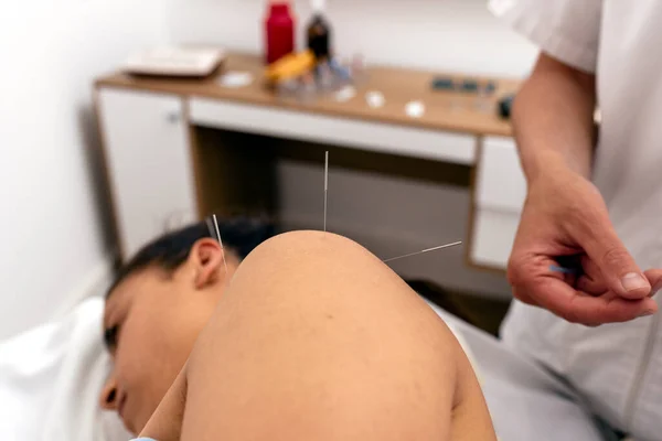 Photo Stock Travailleur Non Reconnu Faisant Une Procédure Acupuncture Une — Photo