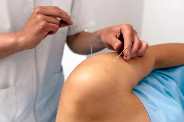 Stock Photo Unrecognized Worker Doing Acupuncture Procedure Female Client Shoulder — Stock fotografie