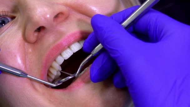 Крупный план стоматолога, делающего профессиональную чистку зубов во рту — стоковое видео