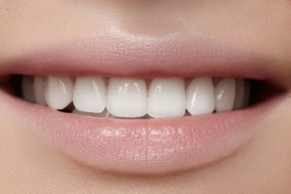 Vackert leende med vitare tänder. Dental foto. Makro närbild av perfekta kvinnliga mun, lipscare rutin — Stockfoto