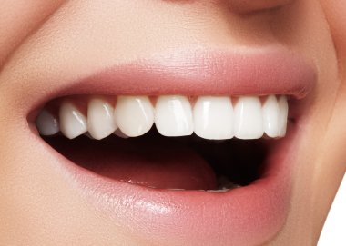Diş beyazlatma ile güzel gülümseme. Diş fotoğraf. Makro closeup lipscare rutine mükemmel kadın ağız