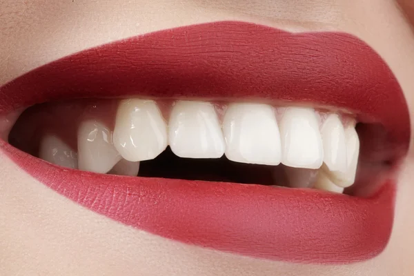 Hermosa sonrisa con dientes blanqueadores. Foto dental. Maquillaje de labios de moda perfecta. Salud sonrisa femenina feliz. Macro primer plano de la boca de la mujer. Cuidado con los dientes — Foto de Stock