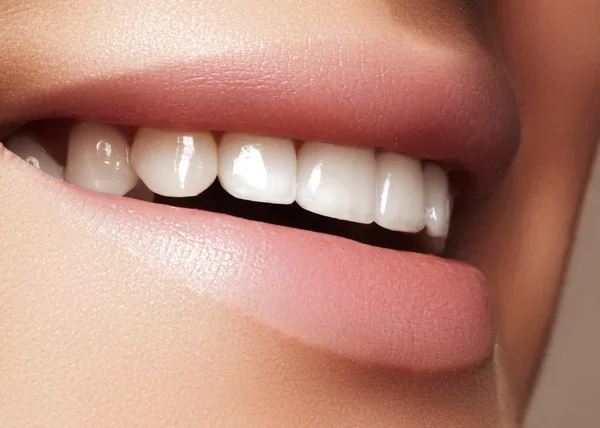 Bel sorriso con sbiancamento dei denti. Foto dentale. Macro primo piano di perfetta bocca femminile, lipspaventare rutina — Foto Stock