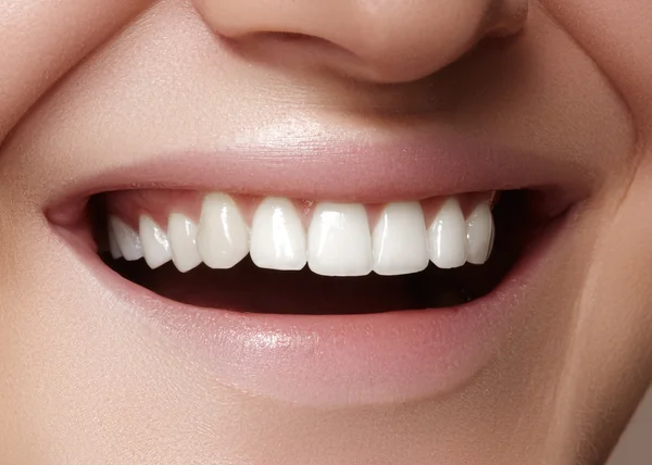 Vackert leende med vitare tänder. Dental foto. Makro närbild av perfekta kvinnliga mun, lipscare rutin — Stockfoto