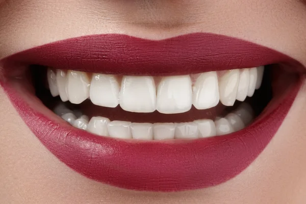 Hermosa sonrisa con dientes blanqueadores. Foto dental. Maquillaje de labios de moda perfecta. Salud sonrisa femenina feliz. Macro primer plano de la boca de la mujer. Cuidado con los dientes — Foto de Stock