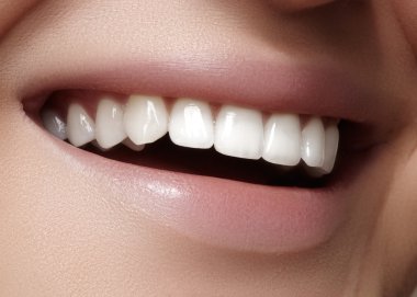 Diş beyazlatma ile güzel gülümseme. Diş fotoğraf. Makro closeup lipscare rutine mükemmel kadın ağız
