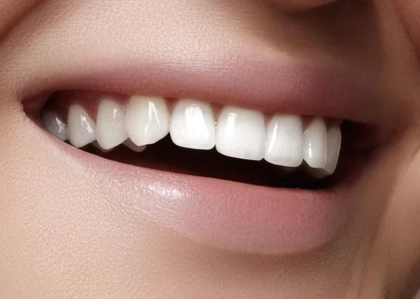 Vackert leende med vitare tänder. Dental foto. Makro närbild av perfekta kvinnliga mun, lipscare rutin — Stockfoto