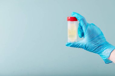 Mavi desenli arka planda ilaç tutan mavi tıbbi eldivenleri teslim edin. COVID-19. Üst Manzara. Boşluğu kopyala.