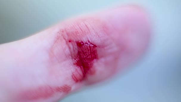 A wound on a finger and blood macro — Stock Video