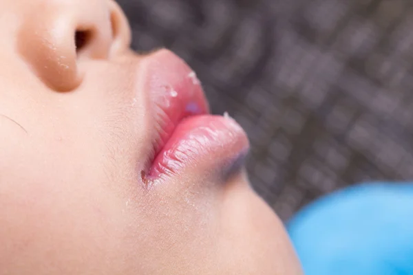 Köşedeki ağızda iltihaplanma var. B2 vitamini eksikliği. Zayıflık kavramı.