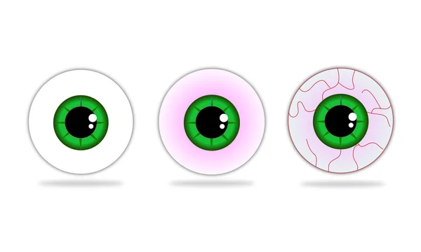 Sequence of irritation of eyeball — Stock Vector