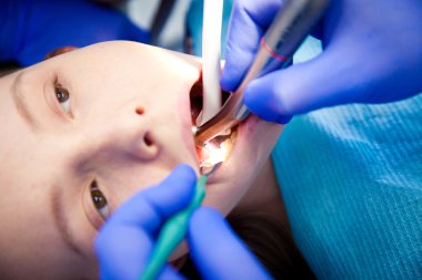 diş hekimi diş muamelesi yapıyor.